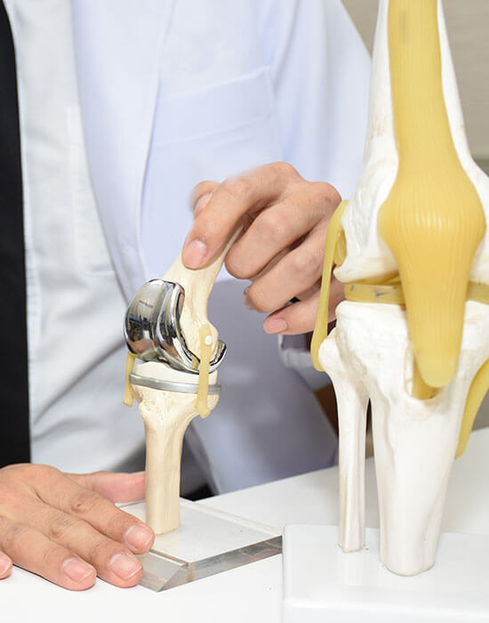 What is Total Knee Replacement?