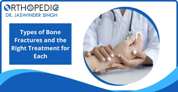 Types of bone fracture