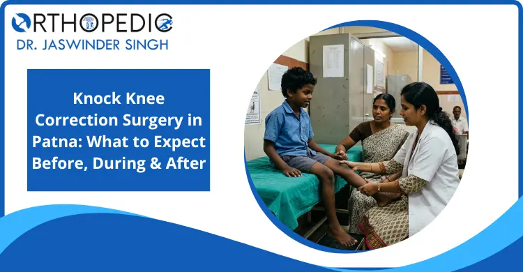 knock-knee-correction-surgery-in-patna