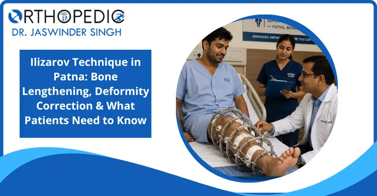 ilizarov-technique-in-patna-bone-lengthening-deformity-correction