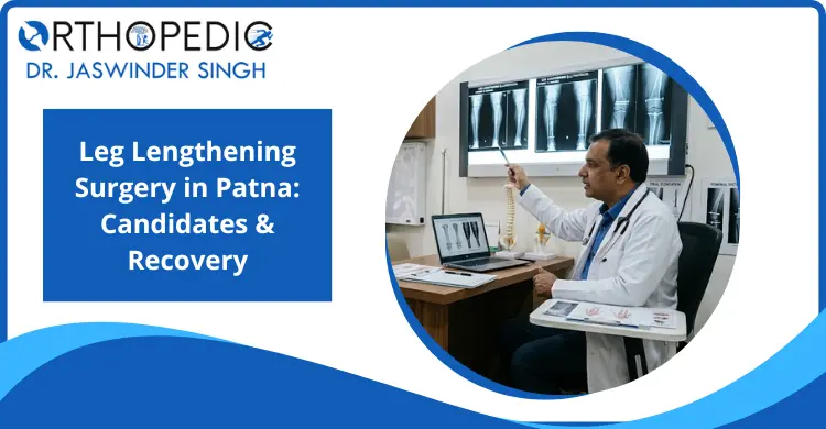 leg-lengthening-surgery-in-patna-candidates-recovery